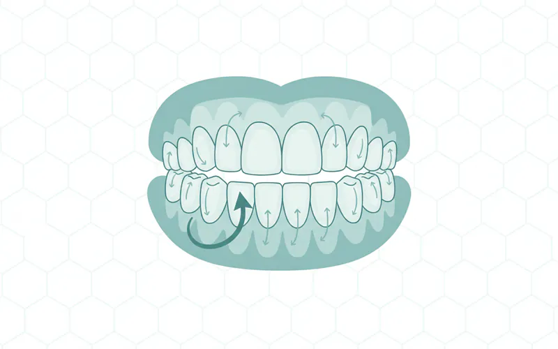 A detailed diagram of a child's mouth showing all 20 primary teeth, color-coded or numbered, with an arrow pointing to the lower central incisors as "first to erupt" and illustrating the sequential order of eruption based on the described timeline.