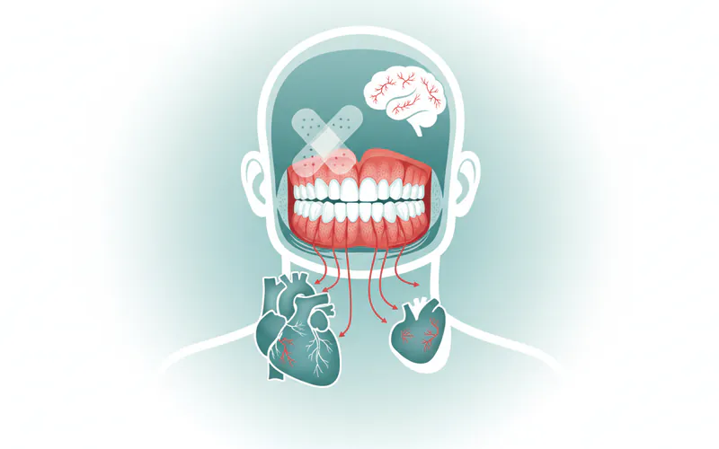 Illustration related to Risks and Complications of Untreated Gum Inflammation