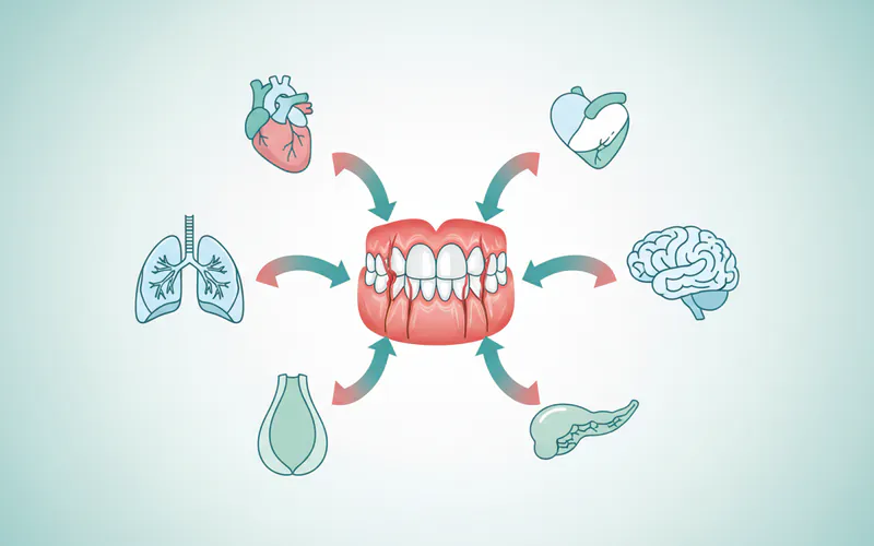 An infographic depicting the oral-systemic link, showing arrows from inflamed gums pointing to various organs like the heart, lungs, pancreas, and brain.