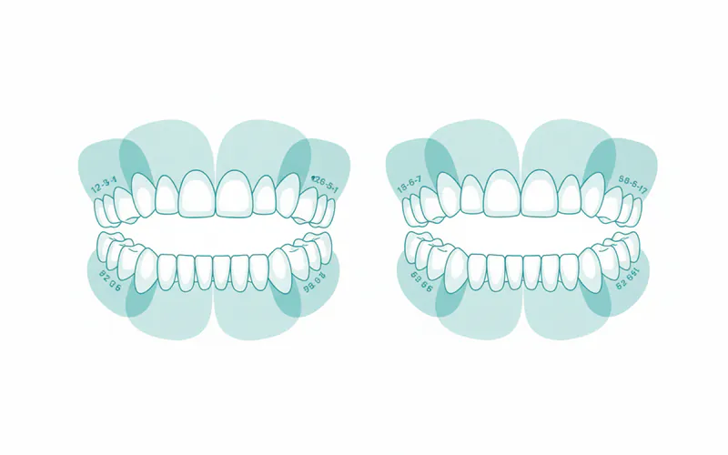 A detailed diagram showing the typical permanent tooth eruption sequence with age ranges for each tooth type highlighted on a dental arch