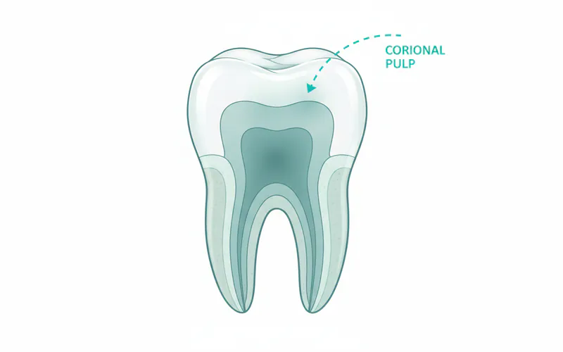 Diagram showing the internal anatomy of a tooth (enamel, dentin, pulp chamber, root canals) with an arrow pointing to the coronal pulp, indicating the area treated by a pulpotomy.