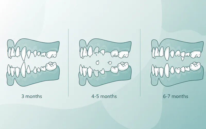 Illustration related to How long does puppy teething last?