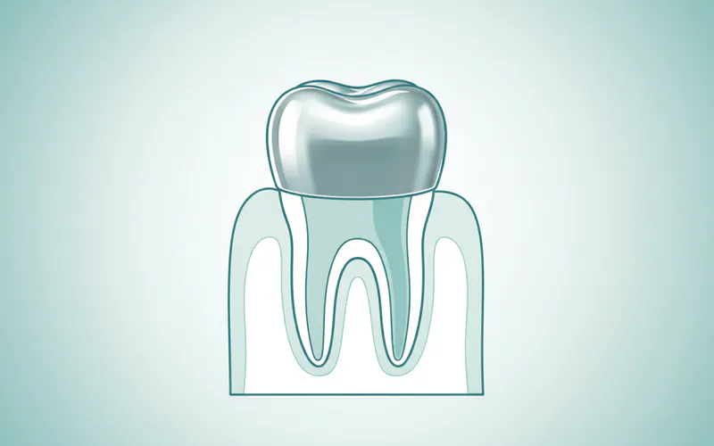 Illustration related to Crowns for Children