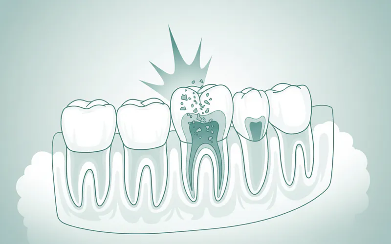 Illustration related to Trauma in Children