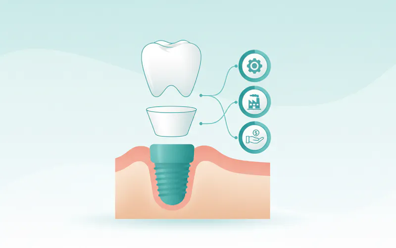 Illustration related to Cost Breakdown and Making Single Implants More Affordable