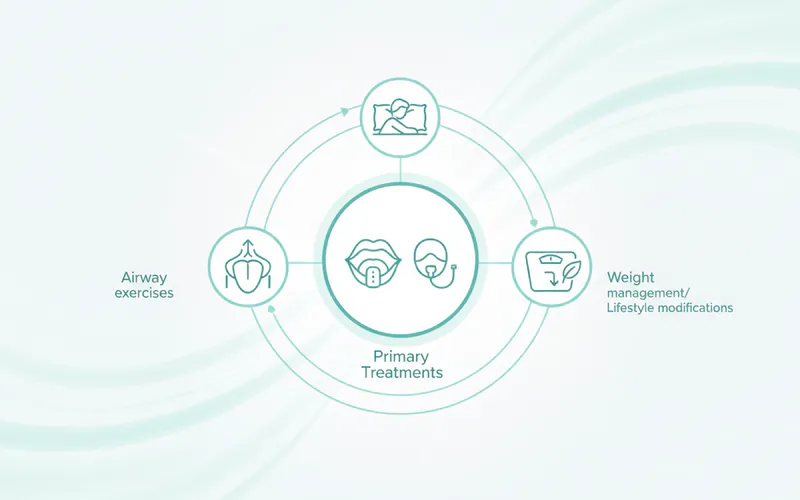 Illustration related to Beyond CPAP and Oral Appliances: Other Treatment Considerations
