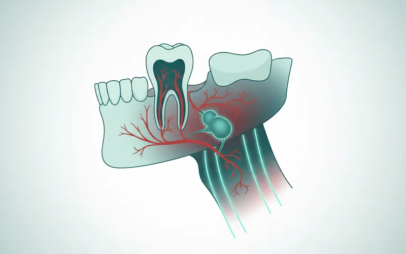 A diagram showing the spread of a dental infection from a tooth root, through the jawbone, and potentially into the neck space, illustrating the path to submandibular lymph node swelling and highlighting areas of concern like the airway.