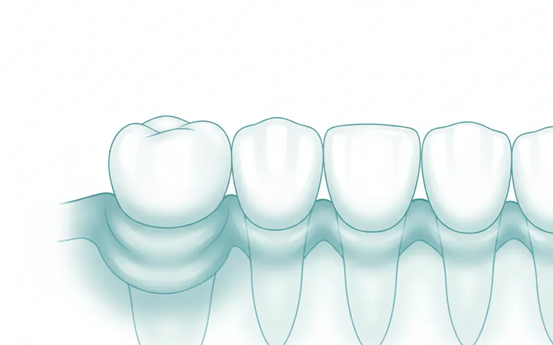 Illustration related to Swelling Gums: Complete Guide