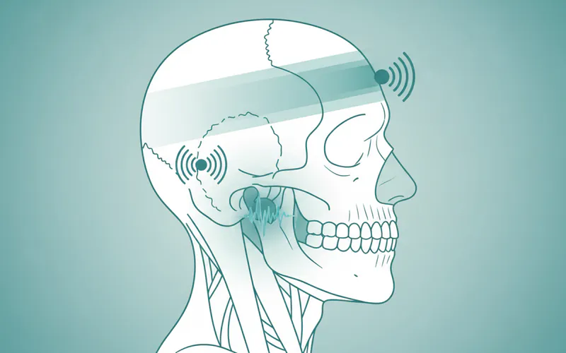 Illustration related to Introduction