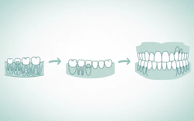 Illustration related to Tooth Eruption Order: Complete Guide