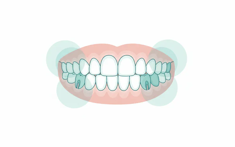 A detailed diagram showing the typical tooth eruption schedule for primary dentition, labeling each tooth type and its average eruption age.