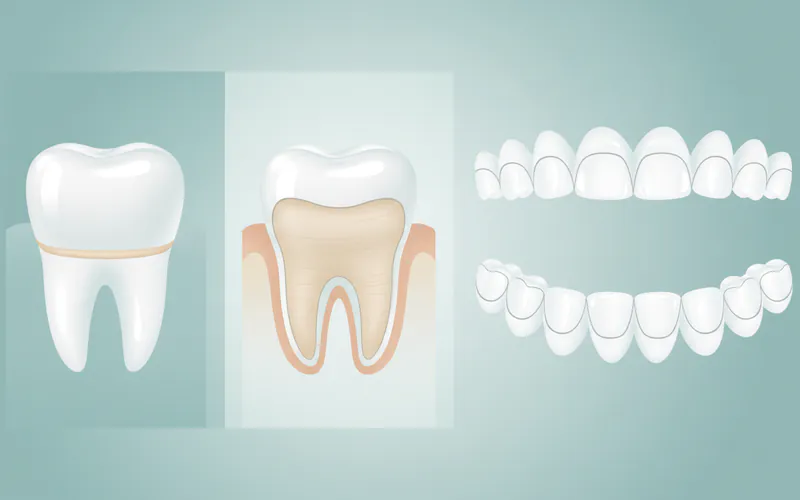 Illustration related to Factors Influencing Cost: