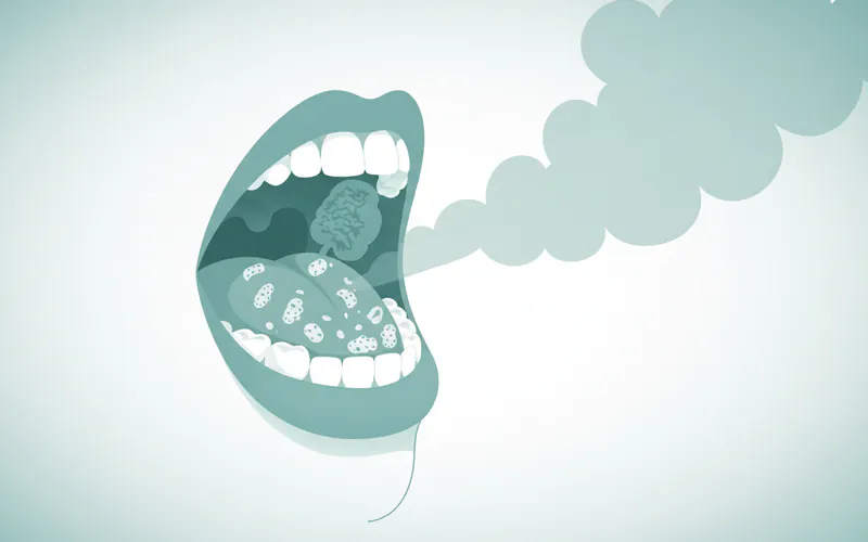 Illustration related to What It Is / Overview