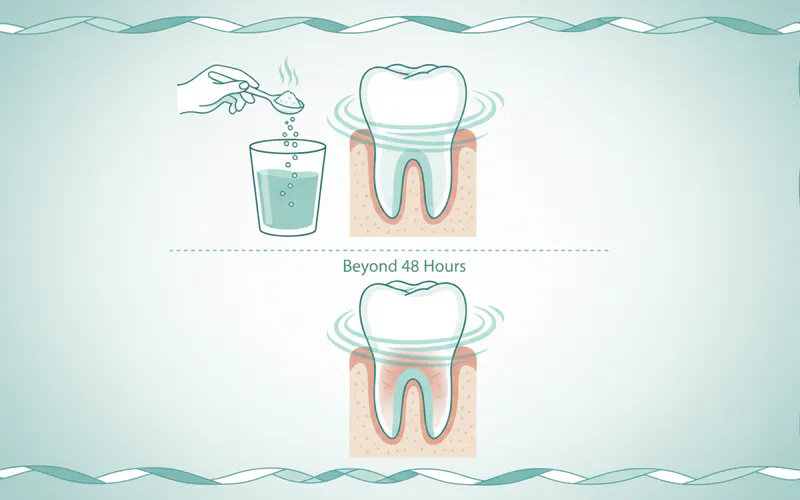 Illustration related to Beyond 48 Hours: