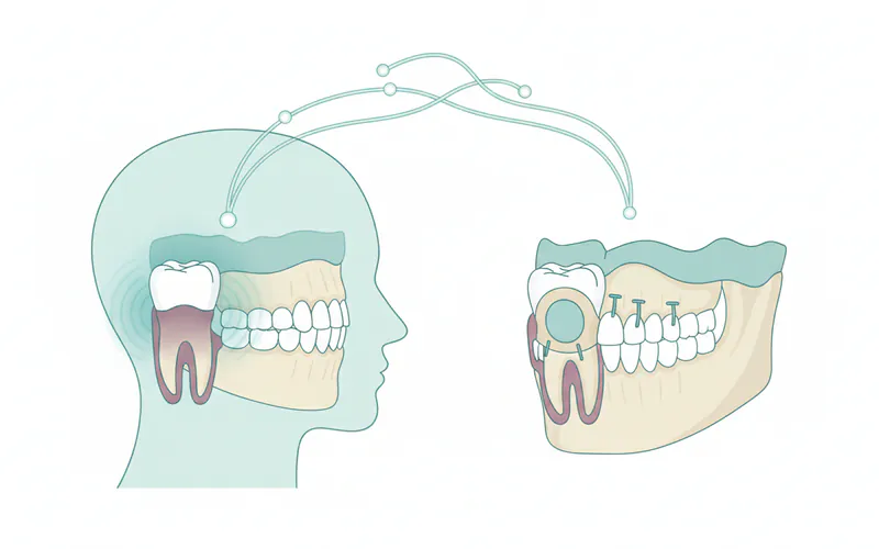 Illustration related to Wisdom Tooth Extraction: Complete Guide