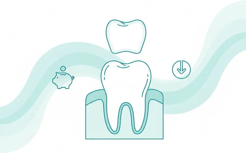 Illustration related to Average US Cost Ranges for a Single Zirconia Crown