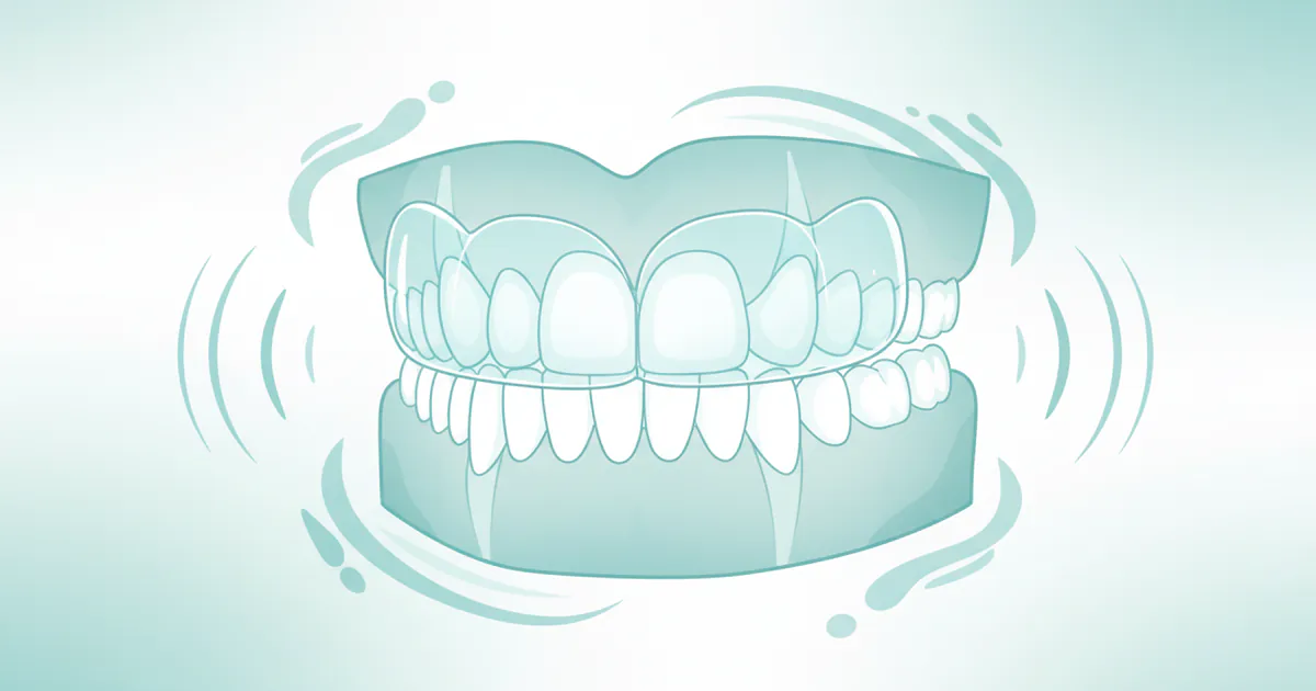 Night Guard for Grinding Teeth: Complete Guide