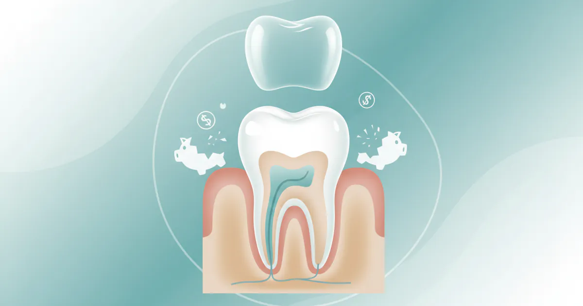 Root Canal and Crown Cost Without Insurance: Complete Price Guide 2026