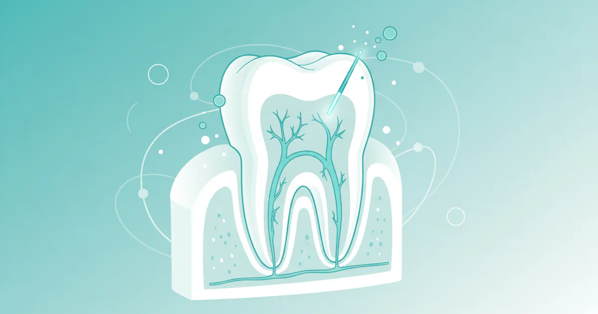 Root Canal Near Me: Complete Guide