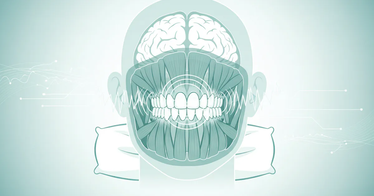 Teeth Clenching at Night: Complete Guide
