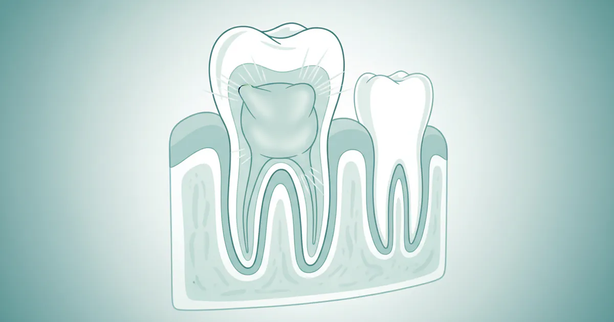 Teeth Swelling: Complete Guide