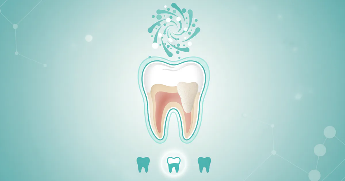 Temporary Tooth Filling: Complete Guide