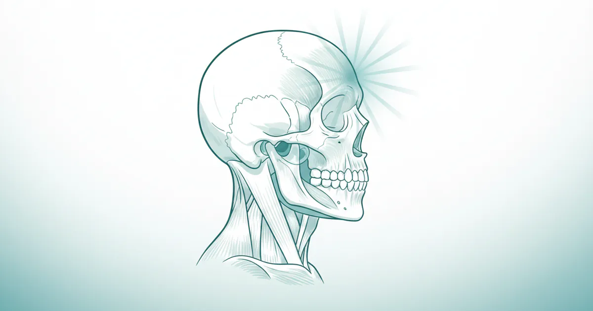 Tmj Headache: Complete Guide