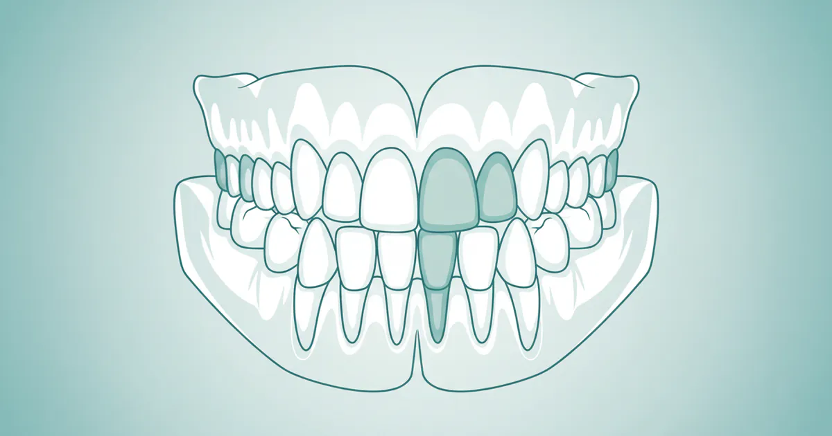 Types of Teeth Diagram: Complete Guide
