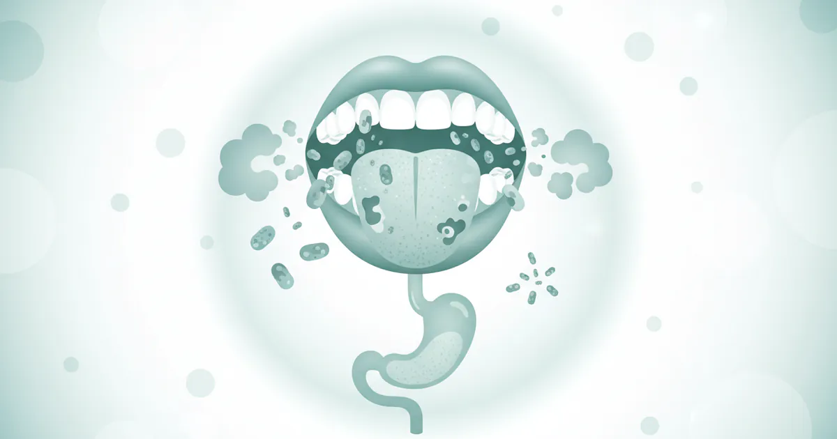 What Cause Bad Breath